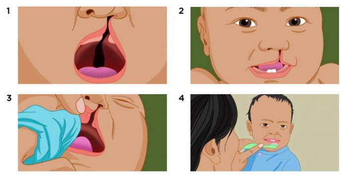 Le guide décrit en détail les soins d'hygiène bucco-dentaires à réaliser de 0 à 18 ans