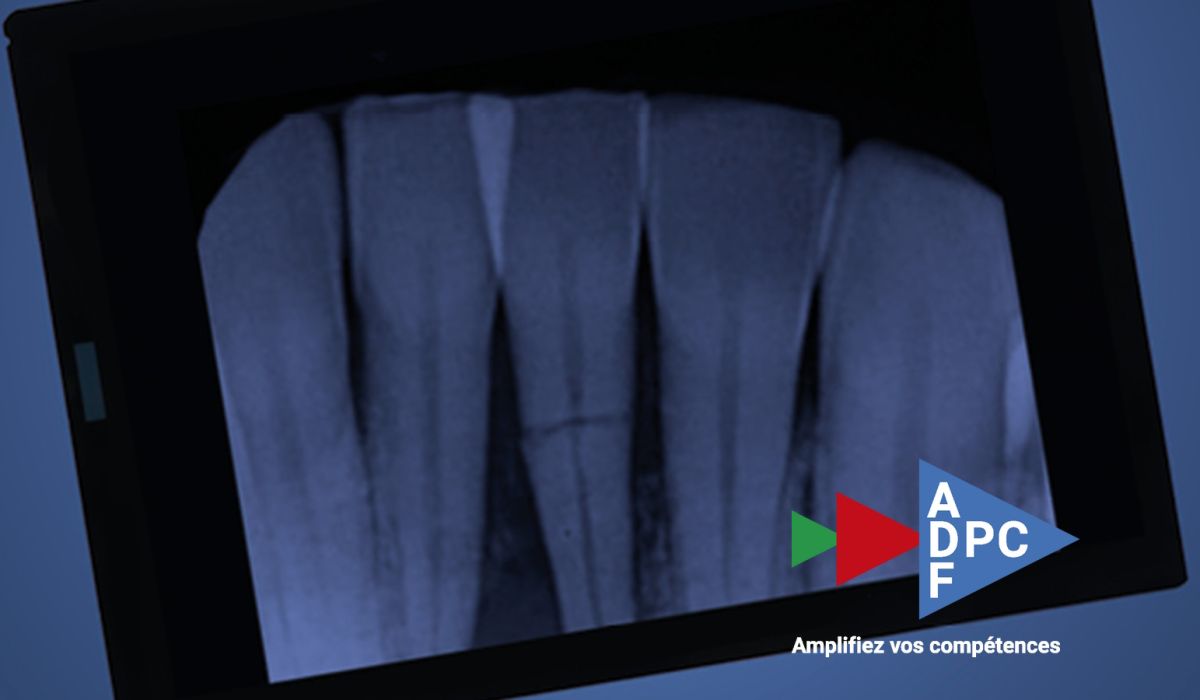 DPC en ligne "Traumatologie dentaire"