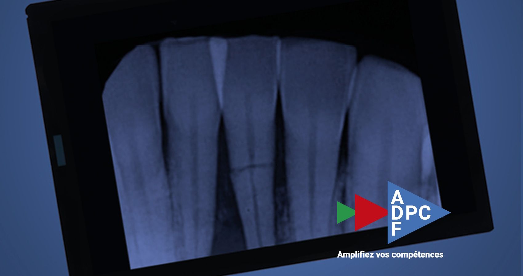 DPC en ligne "Traumatologie dentaire"