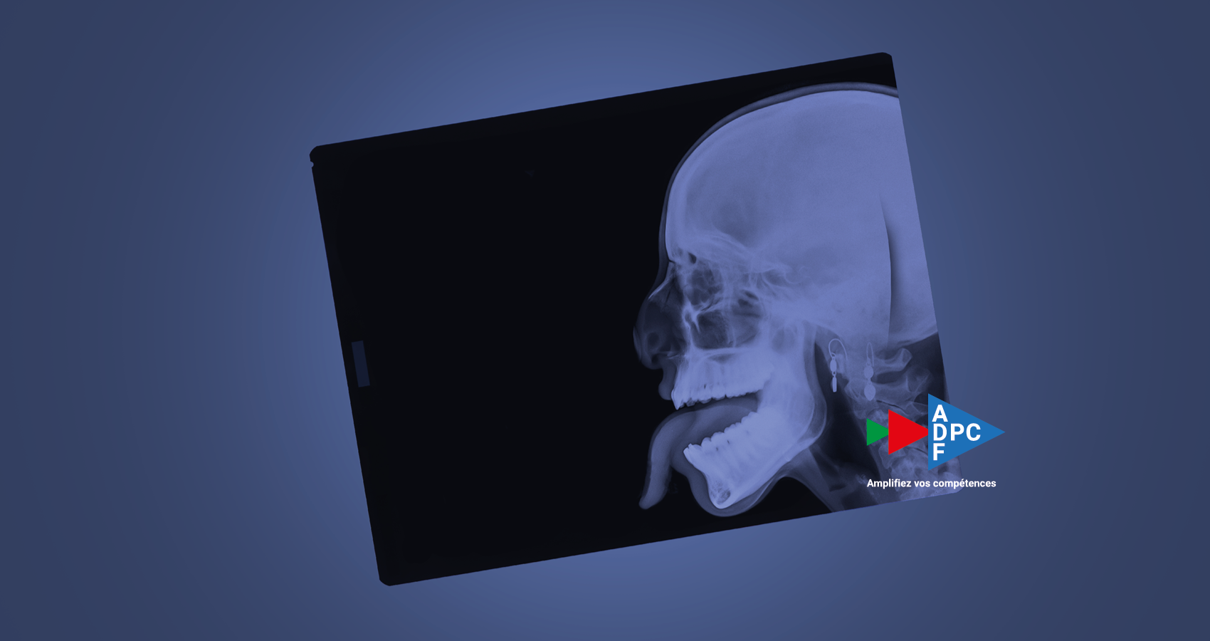Nouveau DPC en ligne "Dermatologie buccale" 