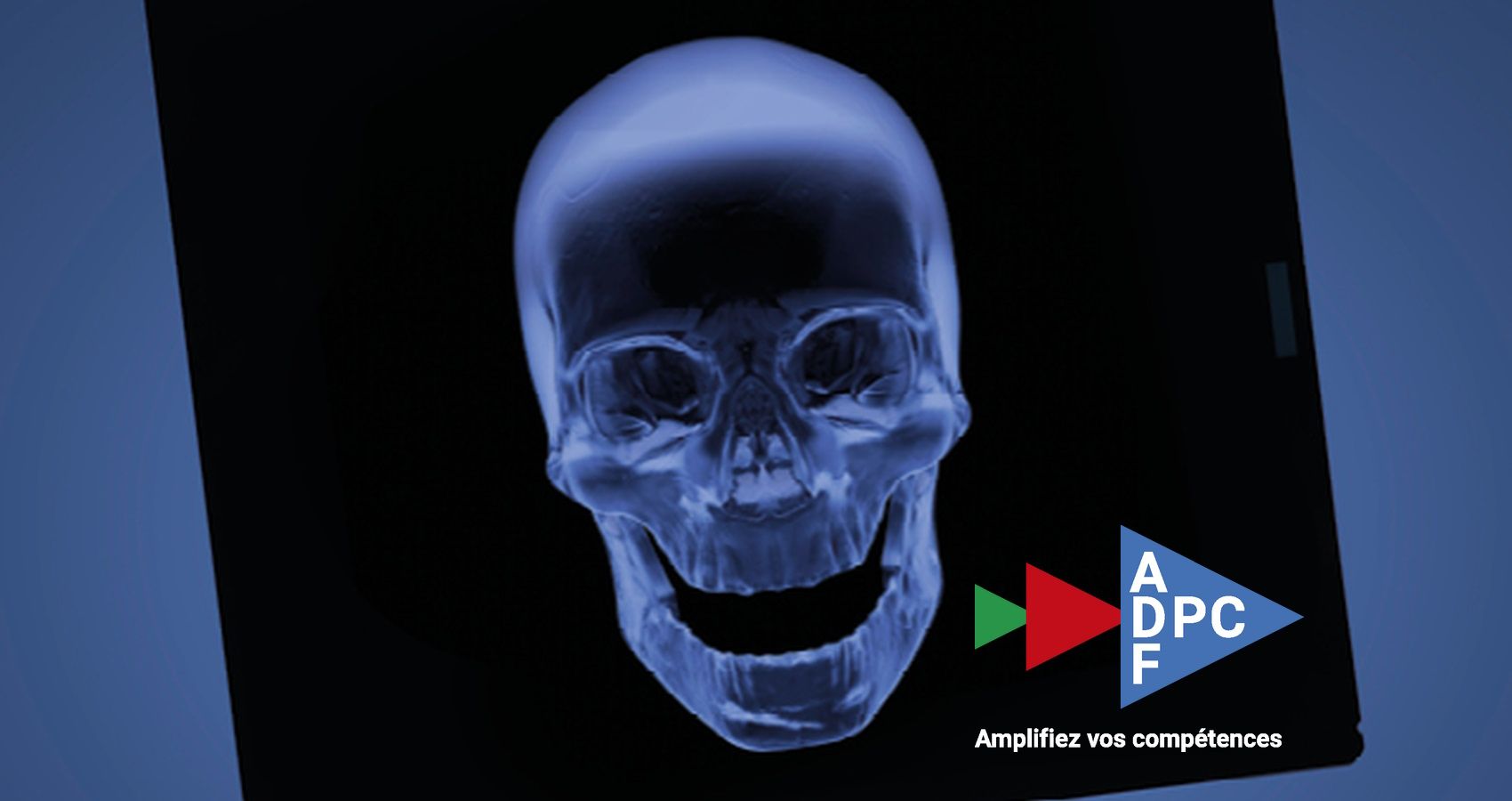 DPC en ligne ADFDPC-Formation "Traitement de l'édenté total : de la prothèse amovible à la prothèse fixée implanto-portée"